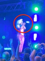 VIDEO: Fanúšik hodil speváčke Bebe Rexhe do hlavy telefón počas koncertu. Skončila v nemocnici s rozťatým obočím