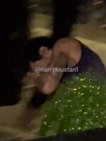 VIDEO: Na vídeňském koncertě hodil fanoušek na Harryho Stylese tvrdý předmět, trefil ho do oka