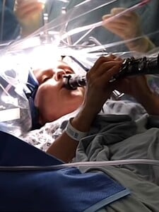 VIDEO: Pacientka s Parkinsonovou chorobou hrala na klarinete počas operácie mozgu. Pocítila okamžité zlepšenie
