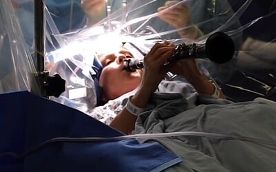 VIDEO: Pacientka s Parkinsonovou chorobou hrala na klarinete počas operácie mozgu. Pocítila okamžité zlepšenie