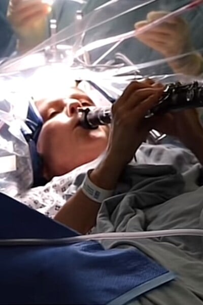 VIDEO: Pacientka s Parkinsonovou chorobou hrala na klarinete počas operácie mozgu. Pocítila okamžité zlepšenie