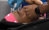 VIDEO: Rafael Nadal si na US Open rozbil nos vlastnou raketou. Krvavú ranu mu musel ošetriť zdravotník