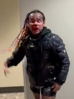 VIDEO: Tekashiho 6ix9ina brutálně napadli a dokopali v posilovně na Floridě