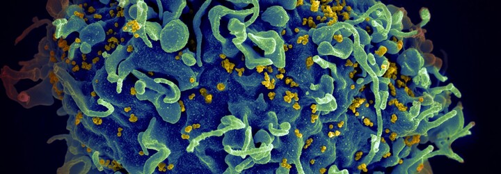 Vakcína proti HIV vypadá slibně. Vědci mají první výsledky testů