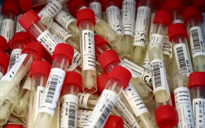 Vakcína proti koronavírusu by mala byť čoskoro hotová. Slovensko podľa ministra Krajčího očakáva prvé dodávky začiatkom roka