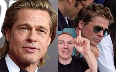 Večne mladý Brad Pitt si podľa lekára pomohol faceliftom. Za omladzujúcu operáciu údajne zaplatil závratnú sumu