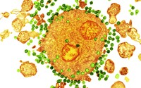 Vedci vyliečili pacienta infikovaného vírusom HIV!