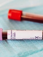 Vedcom sa podaril unikátny nález: Objavili novú krvnú skupinu, patrí žene z Francúzska