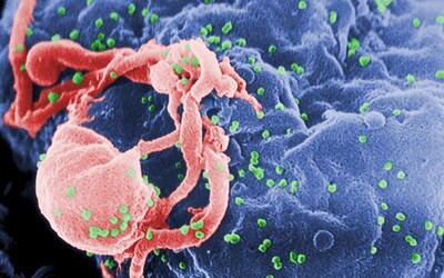 Velká studie ukázala úplné potlačení choroby AIDS léky, přenos mezi muži je nulový
