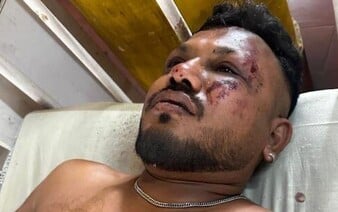 Ze všech cestujících přežil pouze on. Muž popsal, jak se dostal z letadla