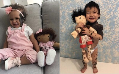 Žena vyrába pre postihnuté deti nedokonalé bábiky s rovnakým hendikepom. Vďaka nim si nepripadajú odlišne