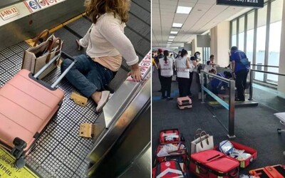 Žene sa na letisku zasekla noha. Končatinu jej museli amputovať