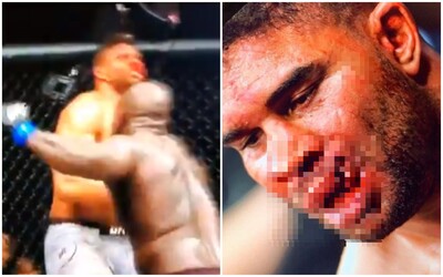 Zranění jako z hororu: Slavný MMA bojovník dostal ránu, která mu zcela roztrhla horní ret