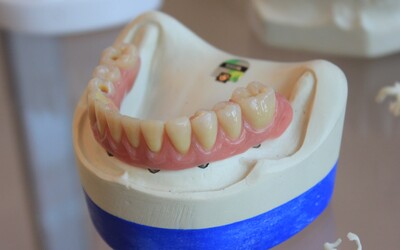 Zubár vytiahol pacientovi skoro 4 centimetre dlhý zub. Zapísal sa do Guinnessovej knihy rekordov