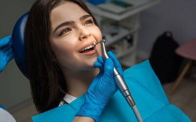 Zubní fazety: Proč cena není to nejdůležitější?