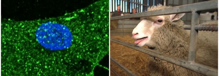 Vědcům se podařilo omladit buňky kůže o 30 let. Použili metodu, pomocí níž v 90. letech naklonovali ovci Dolly