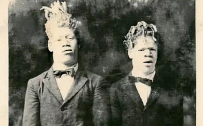 African-American Twins With White Skin Were Abducted As Kids. They Had To Bite Snake Heads And Sleep In Carriages With Bed Bugs. 