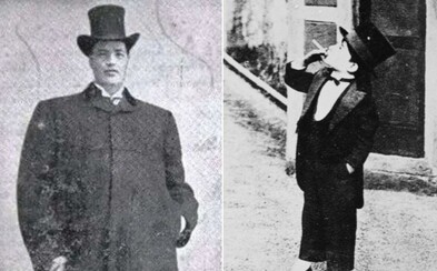 Jako jediný na světě byl trpaslíkem i obrem. Ztrácel zrak i sluch a nepomohli mu ani doktoři Jako jediný na světě byl trpaslíkem i obrem. Ztrácel zrak i sluch a nepomohli mu ani doktoři