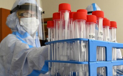 Aktuálna podoba koronavírusu je ešte viac nákazlivá, ako tá spred pár mesiacov, tvrdia vedci Aktuálna podoba koronavírusu je ešte viac nákazlivá, ako tá spred pár mesiacov, tvrdia vedci