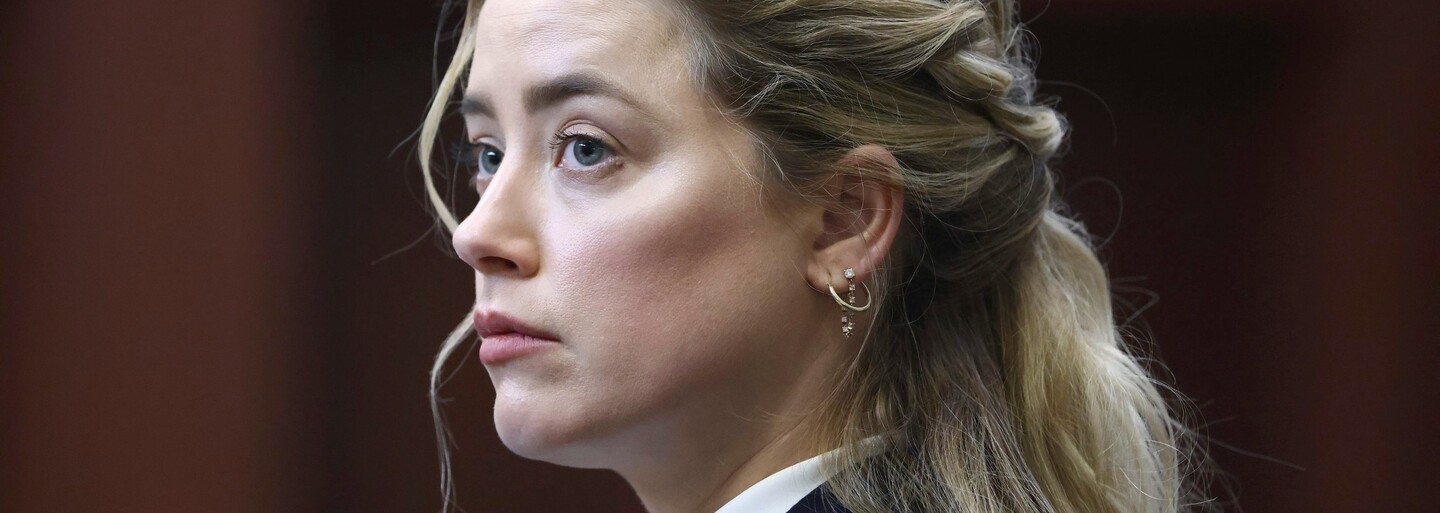 Amber Heard Has Two Personality Disorders, Said The Psychologist. Neither Elon Musk Nor James Franco Will Support Her In Court.