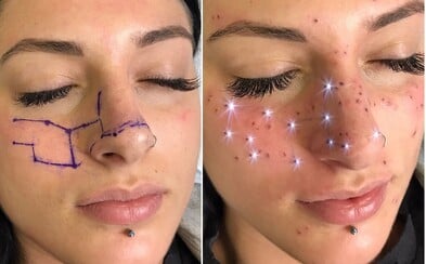 Astropehy sa stávajú najnovším horúcim trendom. Ženy vďaka tomu nosia na svojej tvári súhvezdia Astropehy sa stávajú najnovším horúcim trendom. Ženy vďaka tomu nosia na svojej tvári súhvezdia