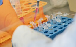 Australští vědci tvrdí, že našli „lék na koronavirus“. Nyní plánují klinické testy po celé zemi