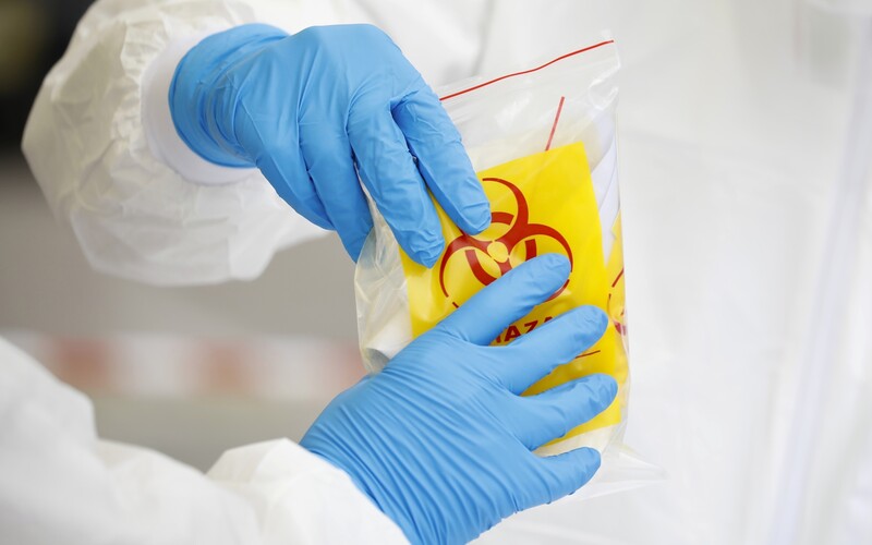 Na koronavirus zemřelo už 29 Čechů.