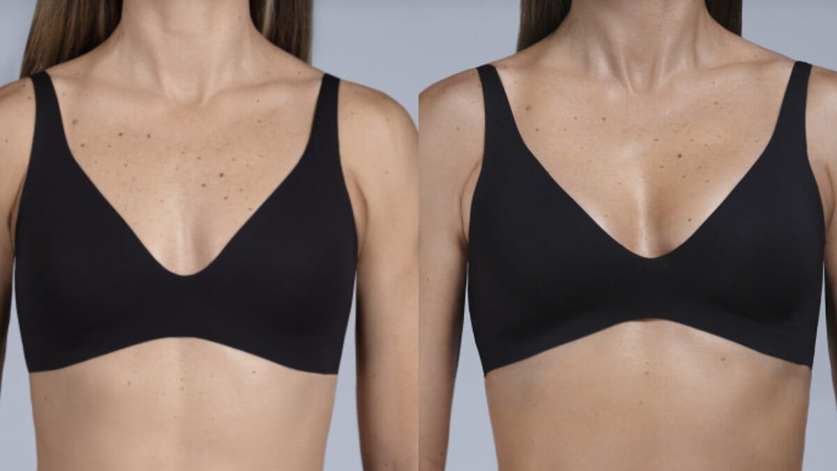 Pred a po zákroku MIA Femtech.