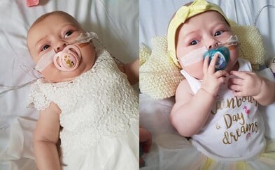 Bábätko, ktoré mohol zabiť aj obyčajný bozk od mamy. Arriella sa narodila s mimoriadne vzácnou diagnózou bez imunity Bábätko, ktoré mohol zabiť aj obyčajný bozk od mamy. Arriella sa narodila s mimoriadne vzácnou diagnózou bez imunity