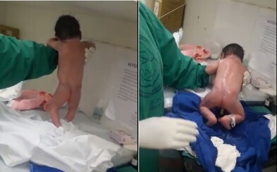 Mimino začalo chodit jen několik sekund po narození. Sestřičky byly u vytržení, ale za kouzelným momentem se skrývá vrozený reflex Mimino začalo chodit jen několik sekund po narození. Sestřičky byly u vytržení, ale za kouzelným momentem se skrývá vrozený reflex