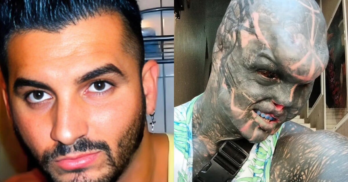 Uřízl si uši, nos a prsty, chystá se na amputaci zdravé nohy a rozpůlení penisu. Anthony chce vypadat jako mimozemšťan