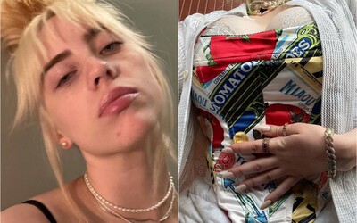 Billie Eilish Swapped Baggy Clothes for Corset Looks