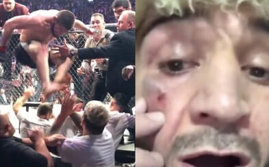 Bratranec Nurmagomedova ukázal dobitú tvár po údere od McGregora. Viacero členov tímu vyviazlo s modrinami a podliatinami Bratranec Nurmagomedova ukázal dobitú tvár po údere od McGregora. Viacero členov tímu vyviazlo s modrinami a podliatinami