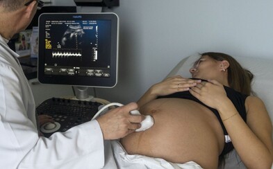 Brazilská varianta je rizikovější pro těhotné ženy, upozorňují tamní úřady. Vyzývají je, aby s oplodněním počkaly Brazilská varianta je rizikovější pro těhotné ženy, upozorňují tamní úřady. Vyzývají je, aby s oplodněním počkaly