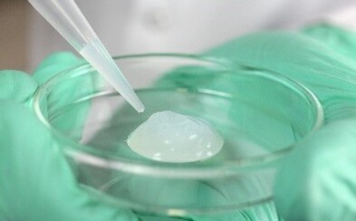 Brněnští vědci vyvinuli unikátní multifunkční hydrogel, kterým budou moci léčit zlomené kosti i popáleniny Brněnští vědci vyvinuli unikátní multifunkční hydrogel, kterým budou moci léčit zlomené kosti i popáleniny