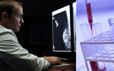 Brněnští vědci získali 100 milionů korun na vývoj látek s protinádorovým účinkem. Mohly by léčit rakovinu Brněnští vědci získali 100 milionů korun na vývoj látek s protinádorovým účinkem. Mohly by léčit rakovinu