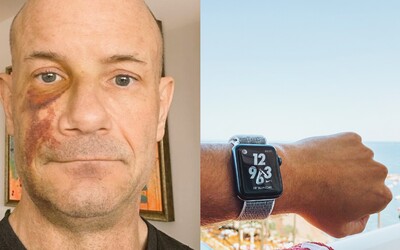 Muž tvrdí, že Apple Watch mu zachránili život