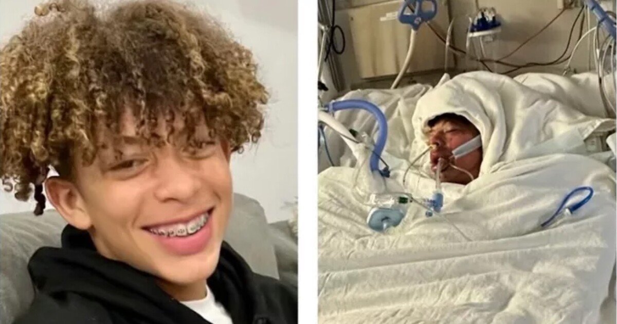 Teenager utrpěl popáleniny na 76 % těla poté, co se pokusil o TikTok výzvu