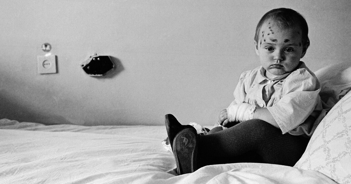 Obrazem: Dojemné fotky dětí z Černobylu. Uplynulo 37 let od největší jaderné katastrofy lidstva