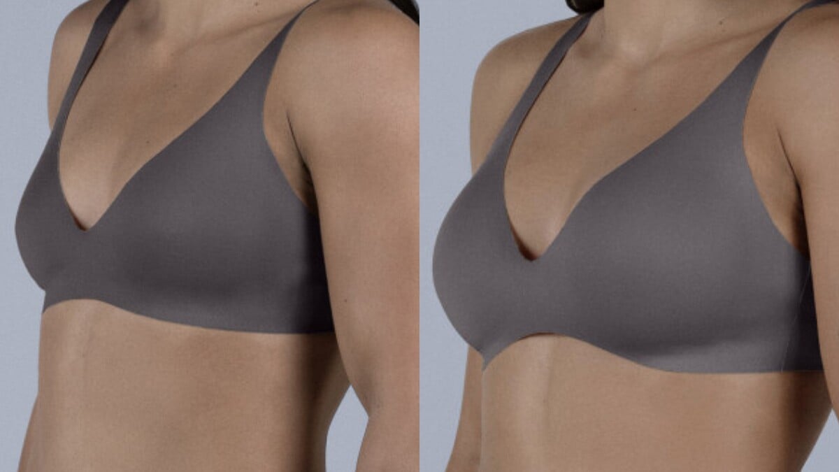 Pred a po zákroku MIA Femtech.