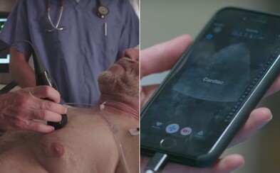 Český vědec spolupracuje na novém zařízení pro iPhone, které umožní odhalit rakovinový nádor i cukrovku Český vědec spolupracuje na novém zařízení pro iPhone, které umožní odhalit rakovinový nádor i cukrovku