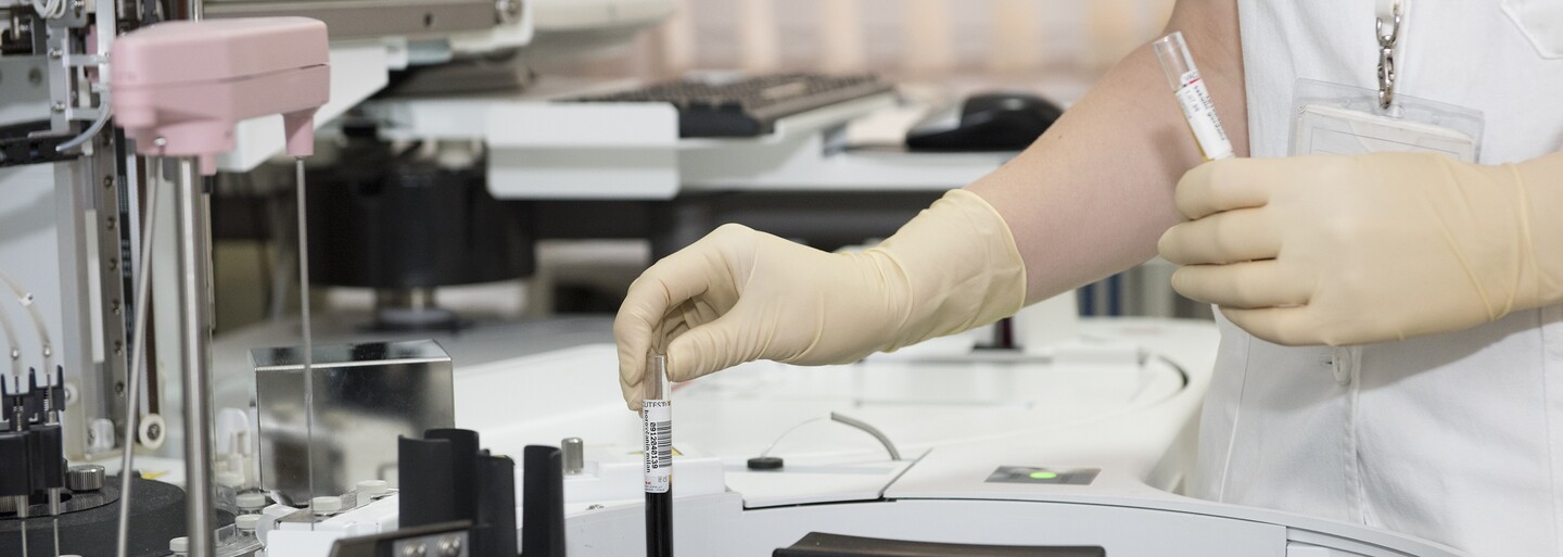 Čeští vědci vytvořili hormon, který dokáže vyléčit obezitu. Jejich výsledky už zaujaly světové farmaceutické firmy