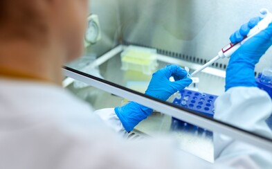 Čínští vědci našli koronavirus i v ejakulátu nakažených pacientů. Není však jasné, zda se sexuálním stykem můžeš nakazit Čínští vědci našli koronavirus i v ejakulátu nakažených pacientů. Není však jasné, zda se sexuálním stykem můžeš nakazit