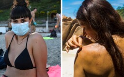 Čo sa ti stane, ak nebudeš používať opaľovací krém? Dermatologička vysvetľuje, prečo ti doslova zachráni kožu