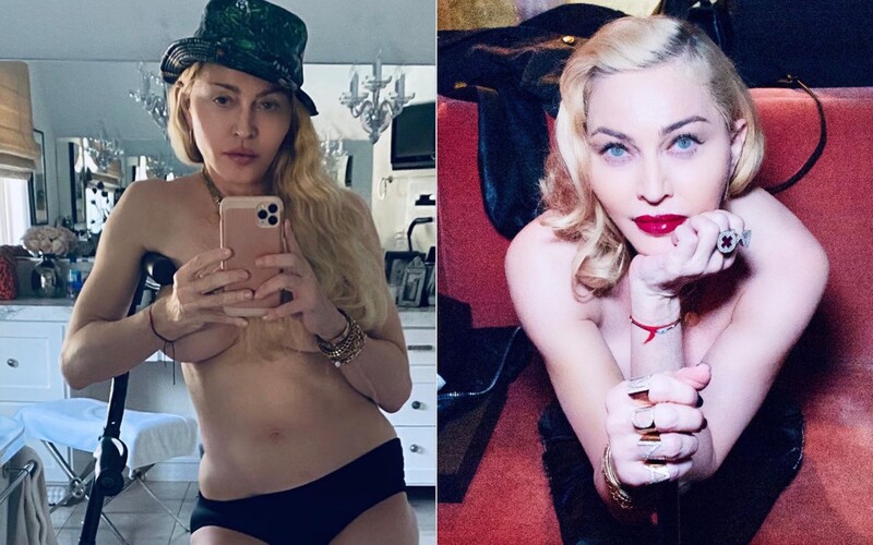 61-ročná Madonna provokuje na Instagrame polonahou fotkou hore bez. Fanúšikov rozdelila na dva tábory.