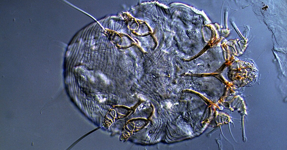 Svrab v Česku: Případů je nejvíc za posledních 20 let. Jak nemoc poznat a léčit?