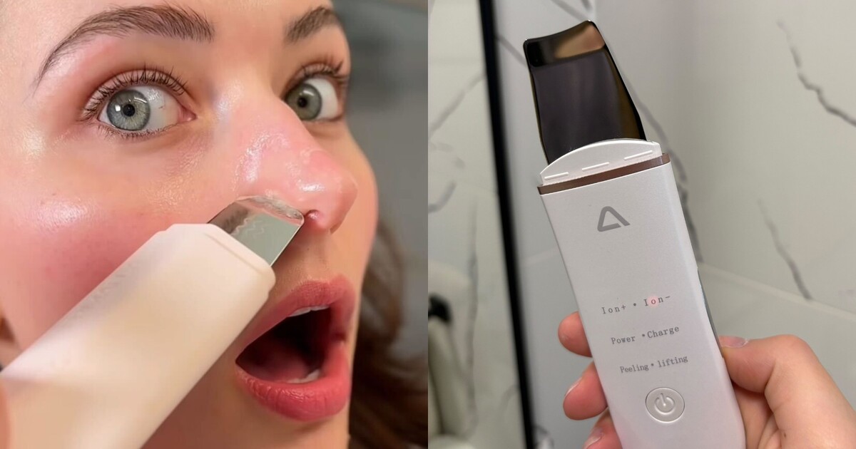 Vyzkoušela jsem ultrazvukovou špachtli na čištění pleti: Jaká má rizika a může nahradit návštěvu kosmetického salonu?