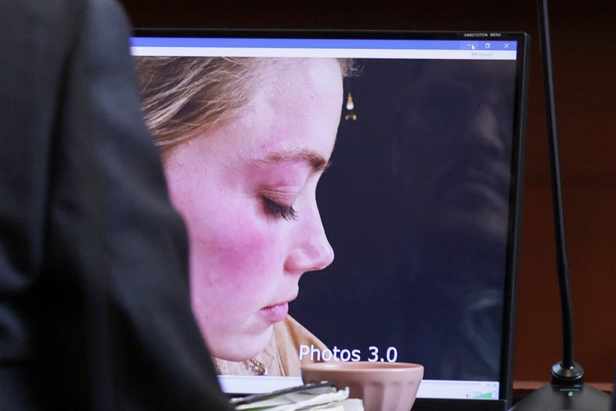 Fotografie Amber Heard s modrinami predložené na súde ako dôkazný materiál. 