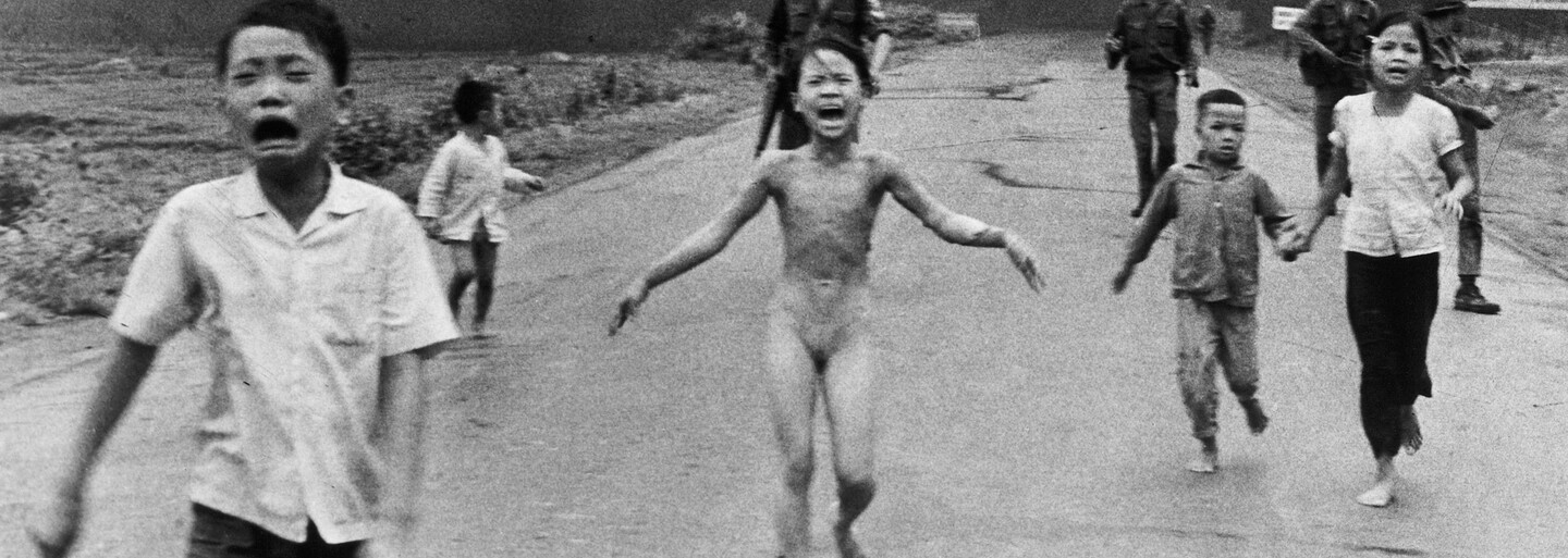 Dívka z ikonické fotky z války ve Vietnamu podstoupila po padesáti letech poslední ošetření kůže