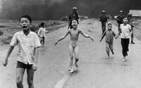 Dívka z ikonické fotky z války ve Vietnamu podstoupila po padesáti letech poslední ošetření kůže